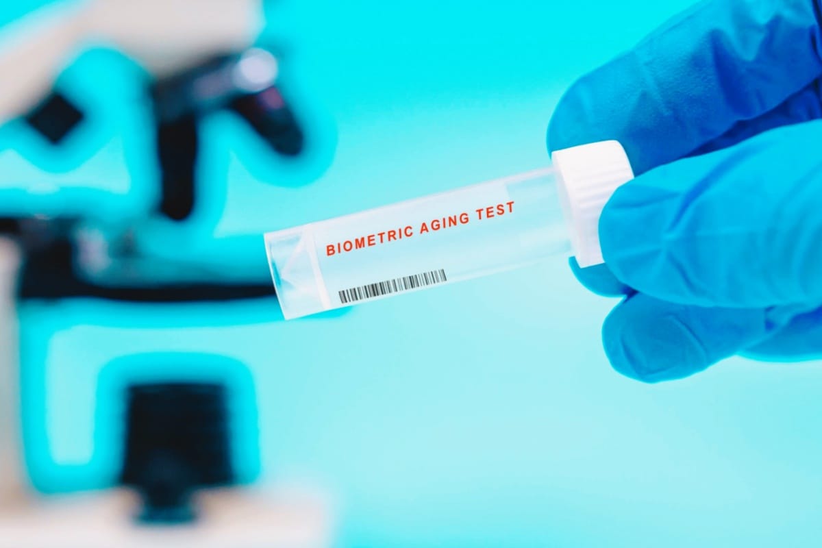 Biologisk ålder blodprover